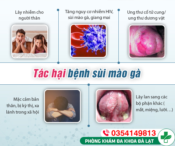 Hình ảnh minh họa